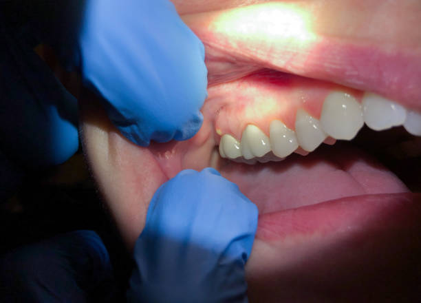 Best Pediatric Emergency Dentist in La Homa, TX