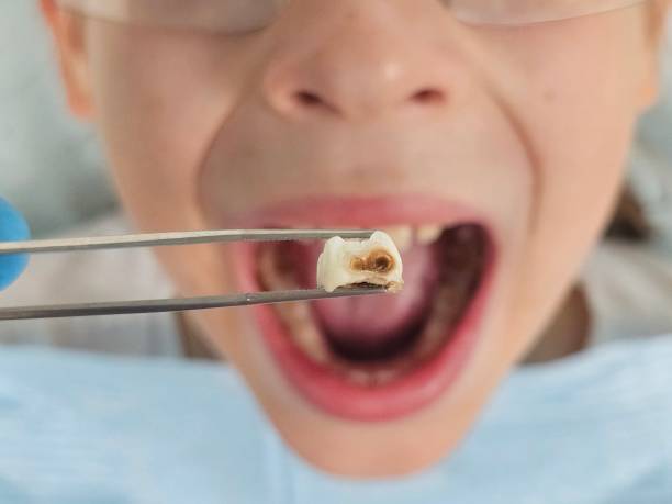Best After-Hours Emergency Dentist in La Homa, TX